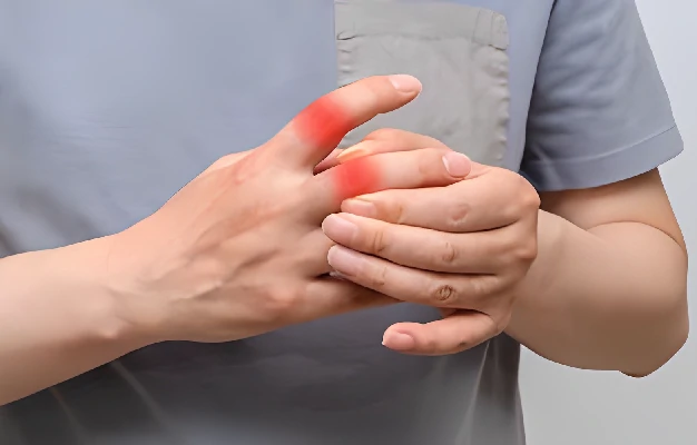 Tidak perlu ke Dokter, Ketahui Bagaimana Gejala Asam Urat dan Pencegahannya Tidak perlu ke Dokter, Ketahui Bagaimana Gejala Asam Urat dan Pencegahannya